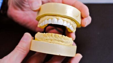 Digital wax-up workflow for dental restorations