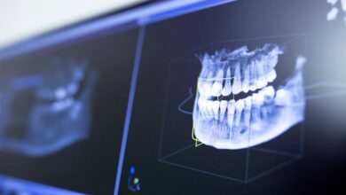 digital dental workflow from scan to design to fabrication